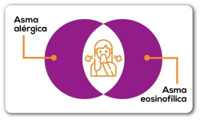 Asma tipo 2, asma eosinofílica y asma alérgica